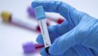 1754 إصابة جديدة بكورونا في قطر