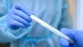 3121 إصابة جديدة بفيروس كورونا في السعودية