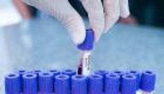 جيناتك تحدد مدى خطورة إصابتك بكورونا