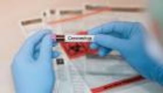 السودان يسجل 12 وفاة و215 إصابة جديدة بكورونا