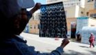 لغز كورونا المدمر.. العلماء في متاهة المشاكل الصحية للفيروس