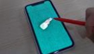 إزالة "سن" من أنف طفلة.. استمر 4 سنوات