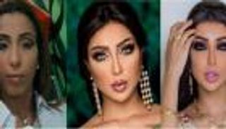 دنيا بطمة.. موهبة استثنائية في "الخروج عن النص"