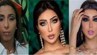 دنيا بطمة تجري عمليات تجميل كثيرة منذ ظهورها