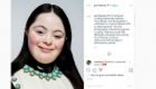 إيلي.. أول عارضة من متلازمة داون لدار جوتشي