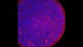 هل يخترق كورونا حاجز الدم ويصيب المخ؟