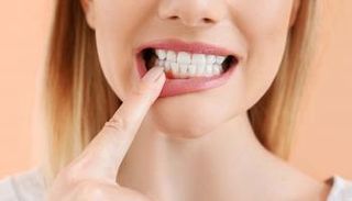 أسباب تورم اللثة وطرق العلاج