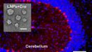 ابتكار "جوازات سفر" نانوية تحمل الدواء للدماغ