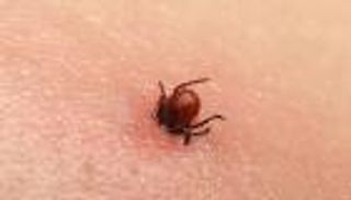 ظهور عدوى نادرة في بريطانيا.. والسبب: لدغة القراد