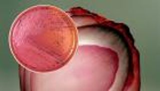 "البصل" يصيب 400 أمريكي بالسالمونيلا