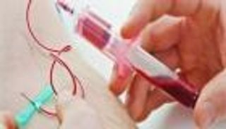 تسمم الدم.. الأسباب والأعراض وطرق الوقاية