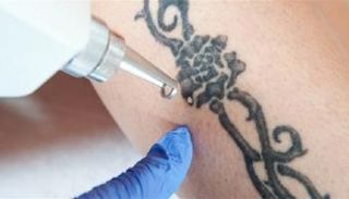 فتوى مصرية تحرم الوشم الدائم