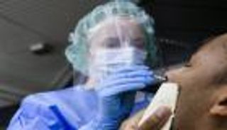 كورونا حول العالم.. الإصابات تتجاوز 21 مليونا و"نيران صديقة" تصيب اللقاح الروسي