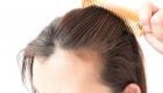 طرق علاج تساقط الشعر