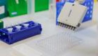 الإمارات: 72 ألف فحص كورونا و131 حالة شفاء