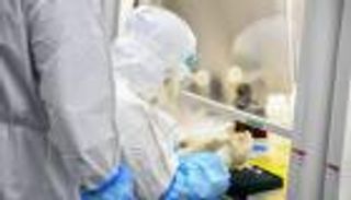 مضاعفات خطيرة تداهم المتعافين من كورونا.. انتبه إلى الذاكرة 