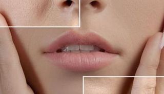 أسباب المسام الواسعة وعلاجها