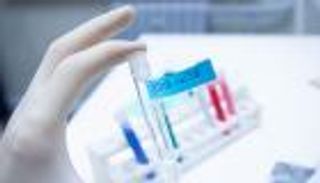 الأردن يسجل أكبر حصيلة يومية لإصابات كورونا