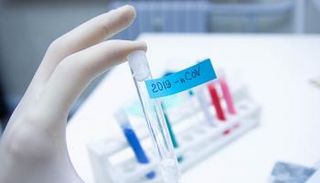 الأردن يسجل أكبر عدد إصابات يومية بفيروس كورونا منذ ظهوره