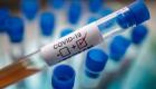 إيطالية تصاب بكورونا بعد الشفاء بـ4 أشهر.. والأطباء: ليست عدوى