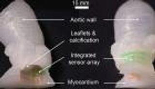 طباعة ثلاثية الأبعاد لصمامات قلب نابضة بالحياة