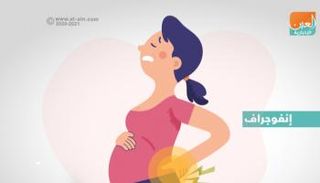 إنفوجراف.. متاعب الحمل