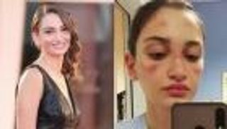 "فينيسيا السينمائي" يكرم رمز مكافحة كورونا في إيطاليا