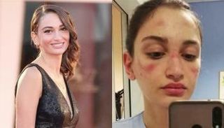 الممرضة الإيطالية المكرمة أليسيا بوناري