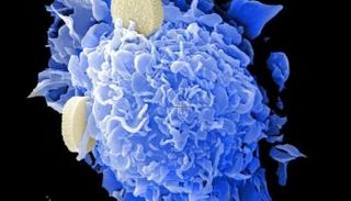 سرطان المبيض يصيب امرأة واحدة تقريبًا من كل 70 امرأة