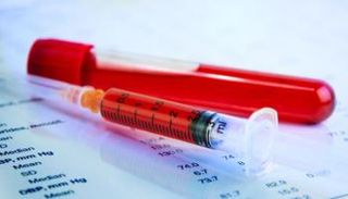 أكثر من 20 مليون شخص حول العالم يعانون من فقر الدم المنجلي