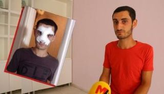 الجندي التركي المصاب دوغان تشاتين