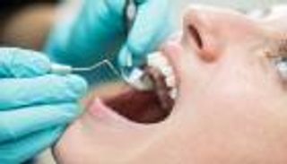 السجن 12 عاما لطبيب خلع سن مريض بطريقة غريبة