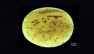 صورة ميكروسكوبية مكبرة للحيوان المنوي المكتشف