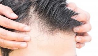 النظام الغذائي المتوازن يعزز نمو الشعر