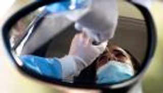 كورونا يترك أثرا مزعجا في الرأس للمرضى والمتعافين