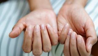 تشققات الأظافر - أرشيفية