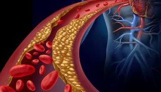 نصائح لخفض الكوليسترول المرتفع