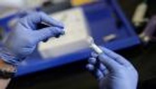 سلوفاكيا تعلن "طوارئ جديدة" لاحتواء كورونا: الوضع خطير جدا