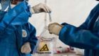 كورونا حول العالم.. البرازيل تسجل 24 ألف إصابة وأمريكا تتجاوز الـ20 مليوناً