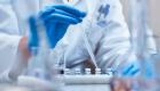 أشد فتكا من كورونا.. مكتشف الإيبولا يحذر من أمراض جديدة