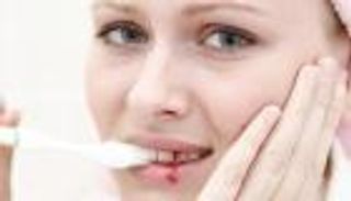 أسباب نزيف اللثة المتكرر.. احذر نقص هذا الفيتامين