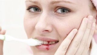 نزيف اللثة المتكرر قد ينذر بالإصابة بمرض خطير