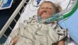 معاناة رضيعة.. عاشت 4 أشهر بـ"بطارية" في حلقها