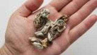 لأول مرة في العالم.. فطر ينمو داخل الأوردة الدموية لرجل