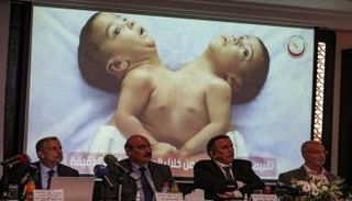 جانب من المؤتمر الصحفي
