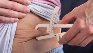 دراسة تؤكد أن "التكميم" أكثر أمانا من جراحات تحويل مسار المعدة