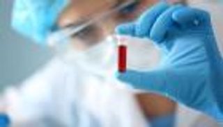 "النوع البخيل".. فصيلة دم تهدد صاحبها بفقدان الذاكرة