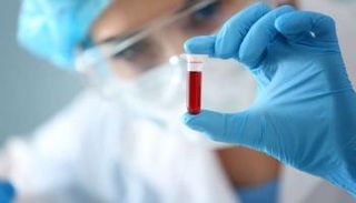 أصحاب فصيلة الدم AB أكثر عرضة للإصابة بفقدان الذاكرة