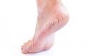 أسباب تشقق الكعبين.. إليك الحل