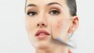 رقائق الشوفان.. سلاح طبيعي لمحاربة شوائب البشرة